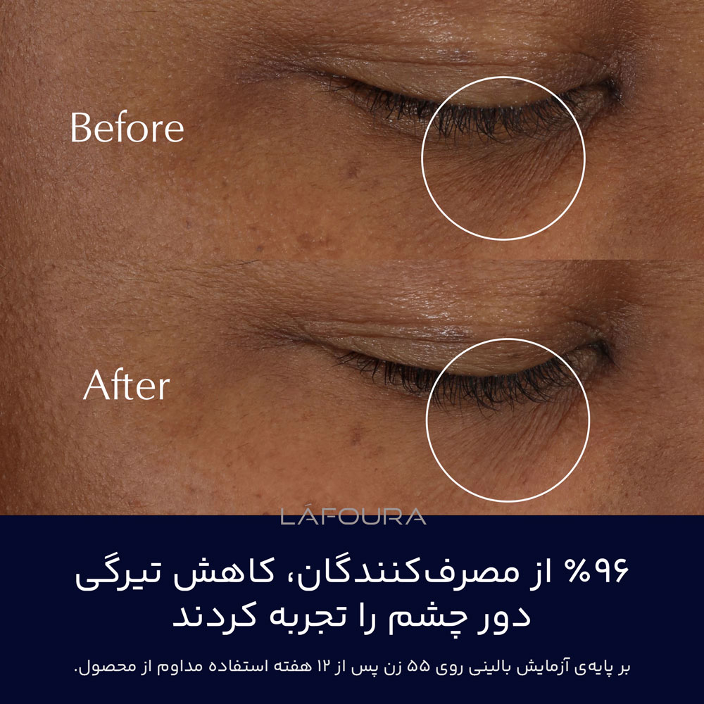 estee-lauder-advanced-night-repair-eye-supercharged-gel-creme-gallery-2 کرم دور چشم ادونس نایت ریپیر استی لودر - Image 3