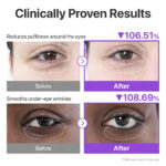 پچ زیر چشم نامبوزین شماره 9 مدل NAD+ Collagen - Image 3