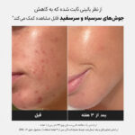 تونر لایه بردار پائولا چویس Paula’s Choice Skin Perfecting 2% BHA - تصویر 2